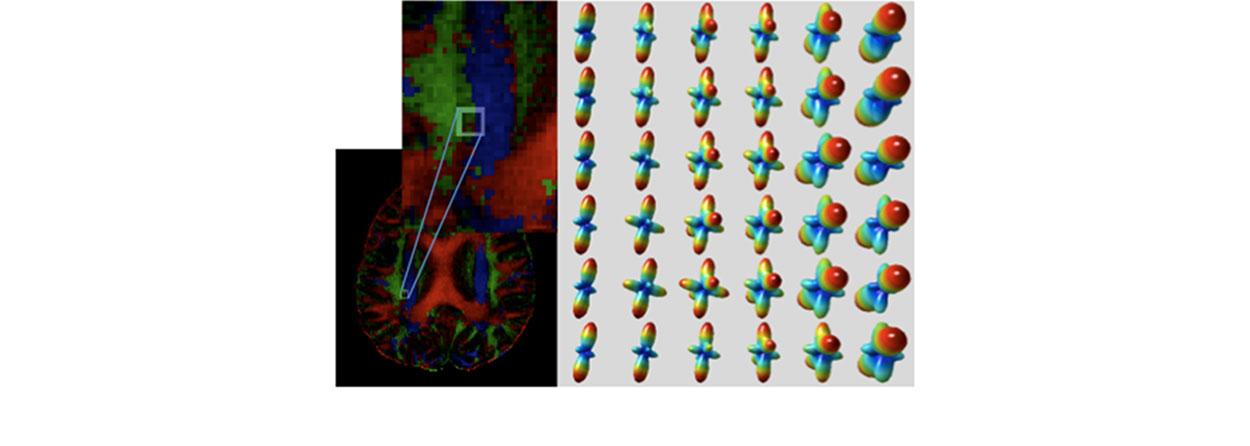 Highly accelerated high resolution diffusion MRI