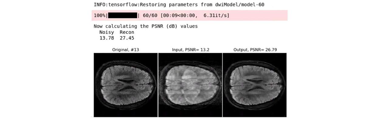 Fast multi-shot dMRI reconstruction using MoDL-MUSSELS